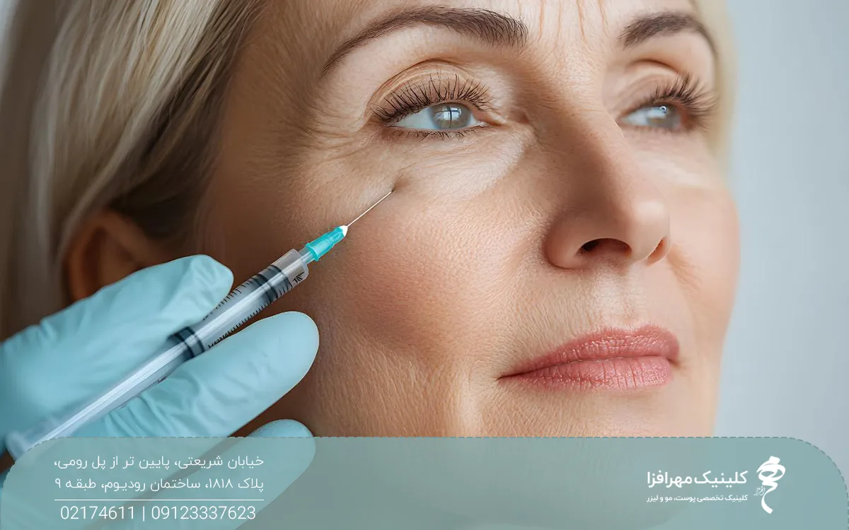 خانمی که به نقطه ای خیره شده است و دست دکتری که در حال تزریق پروفایلو است