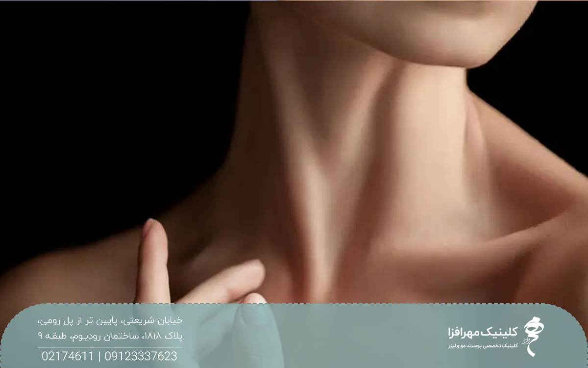 عکسی از چانه و گردن یک دختر