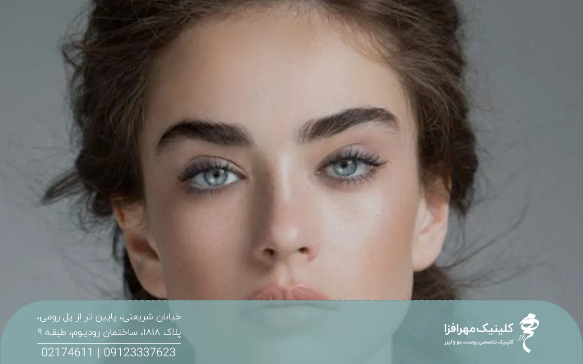 دختری که با چشمان رنگی اش به رو به رو نگاه میکند و ابروهای ضخیمی دارد
