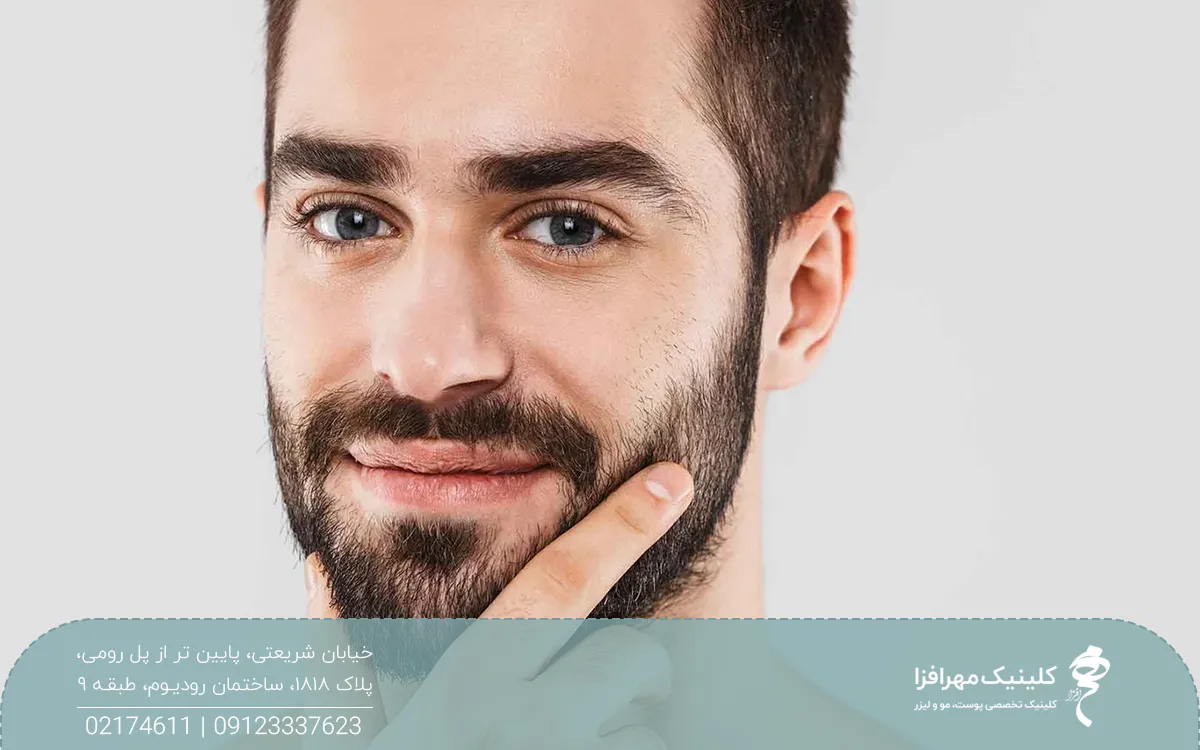 مرد خوشحالی که دستش را روی ریشش گذاشته است و به روبه رو نگاه می کند
