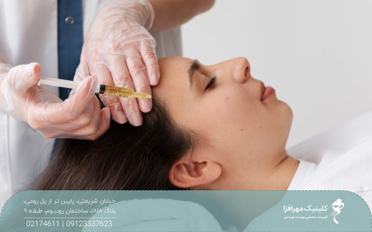 دختری که روی تخت کلینیک دراز کشیده و پزشک به شقیقه او بوتاکس میگرن تزریق می کند