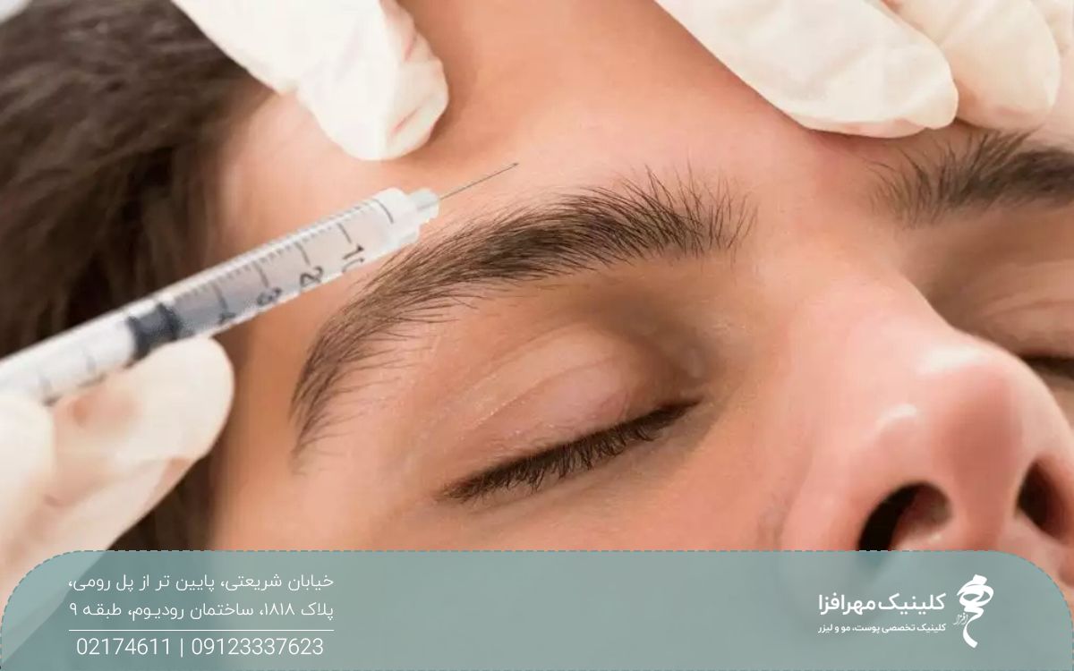 عکس نزدیک از پیشانی مردی که پزشک با سرنگ به پیشانی او بوتاکس تزریق می کند