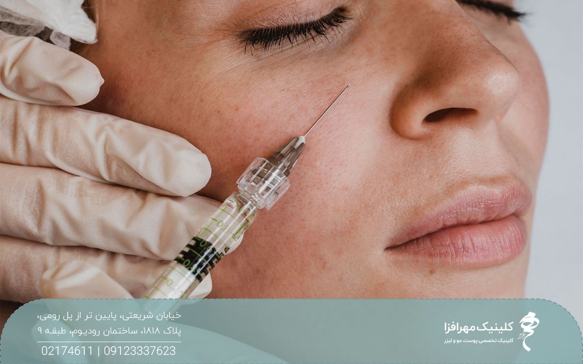 دست پزشکی که سرنگ فیلر را روی گونه دختر نگه داشته است